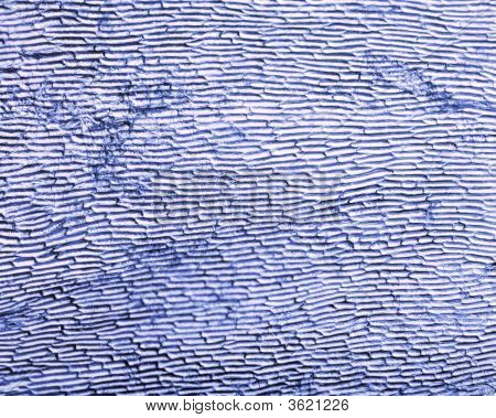 Microscopische UI huidcellen