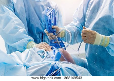 Arthroscope Surgery. Orthopedic Surgeons In Teamwork In The Operating Room