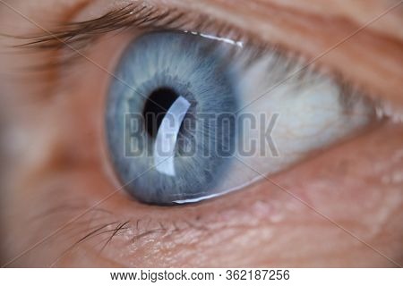 Male Eye Blu Color Super Macro Closeup Shot. Laser Vision Correction And Cataract Treatment Concept