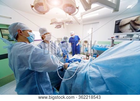 Arthroscope Surgery. Orthopedic Surgeons In Teamwork In The Operating Room