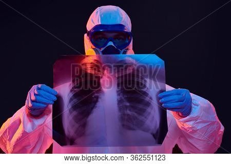 COVID-19 or 2019-nCoV. Portrait of a doctor in a protective PPE suit showing an x-ray picture of the lungs of a patient with coronavirus pneumonia. 