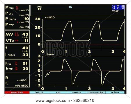 Screen, Monitor With Signs Of The Artificial Lung Ventilation Device In A Realistic Design. Isolated