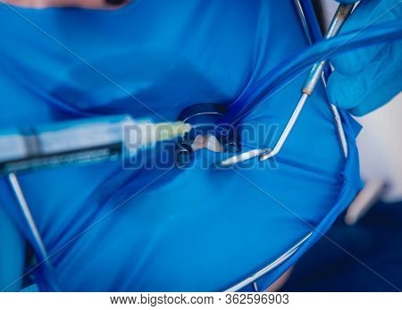 Medicamentous Treatment Of Root Canals During Endodontic Treatment