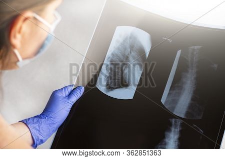 Female Doctor Examining X-ray Film (scan) Thoracic. Concept Of Medical Service, Diagnosis And Treatm
