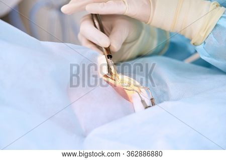 People At Hospital Background. Blue Medical Backdrop. Healthcare Support. Cardiology Sick Patient. O