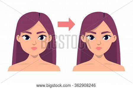 Face Contour Plastic Surgery Vector Isolated Illustration