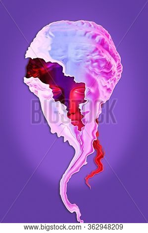 Collage With Plaster Antique Sculpture Of Human Face In A Pop Art Style. Creative Concept Colorful N