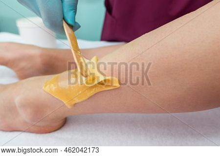Leg Sugaring. A Beautician Makes A Sugar Paste Depilation Of A Woman's Legs In A Beauty Salon. Femal