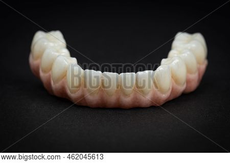 Dental Health Care. Close Up Ceramic Zirconium. Dental Prosthesis On Zirconium Oxide Implants