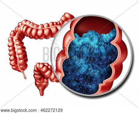 Intestine Bloating And Constipation Anatomy Or Constipated Symptoms As Stool Bowel Movement Problem 