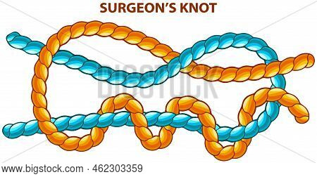 Surgeons Knot Isolated On White. Binding And Fastening Unit For Permanent Bracing. Modification Of S