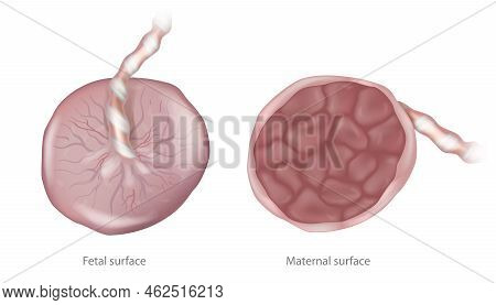 Placenta Maternal Surface And Fetal Surface. Structure Human Placenta