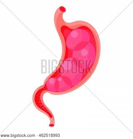 Full Stomach. Heaviness Of Stomach, Bloating, Pain In The Alimentary Tract And Acid Heartburn. Duode