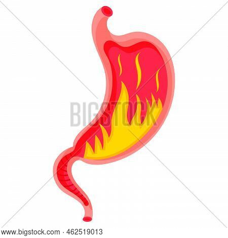 Full Stomach. Heaviness Of Stomach, Bloating, Pain In The Alimentary Tract And Acid Heartburn. Duode