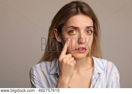 Woman Checking Her Health Condition On Grey Background. Yellow Eyes As Symptom Of Problems With Live