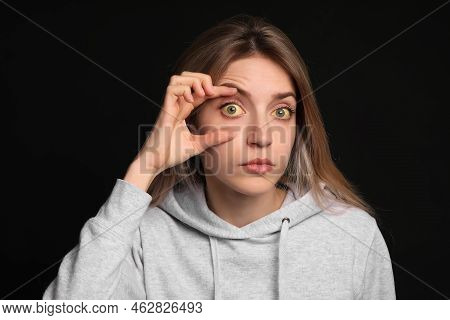 Woman Checking Her Health Condition On Black Background. Yellow Eyes As Symptom Of Problems With Liv