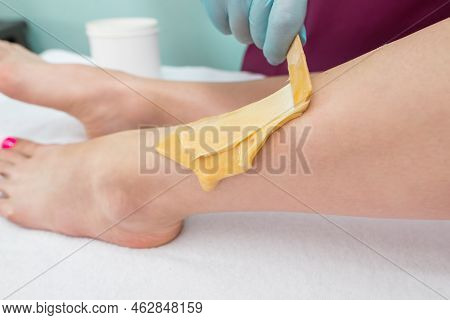 Leg Sugaring. A Beautician Makes A Sugar Paste Depilation Of A Woman's Legs In A Beauty Salon. Femal