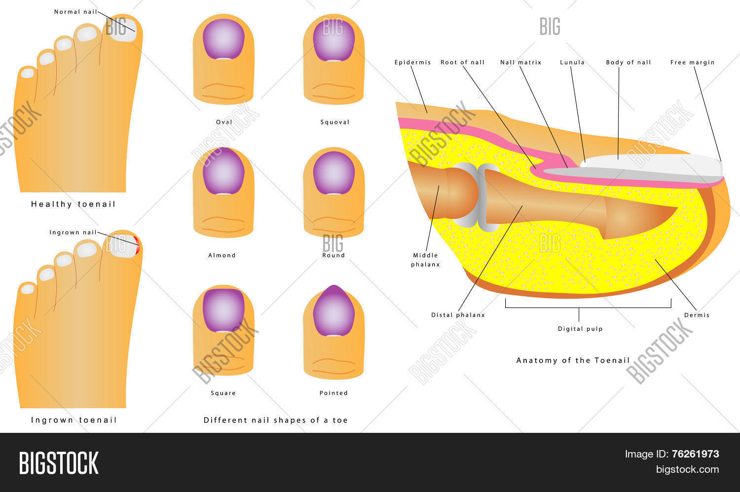 Toenail Vector & Photo (Free Trial) | Bigstock