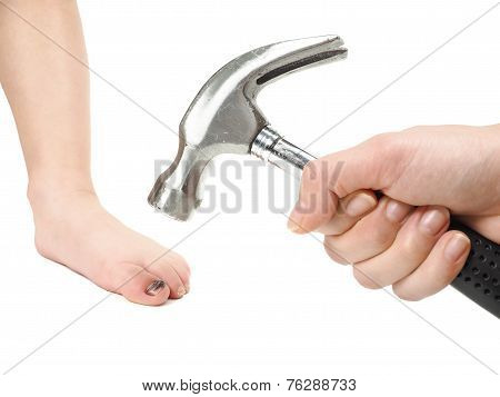 Someone Holding A Hammer Over A Child's Foot With Blue Hallux Nail After Injury
