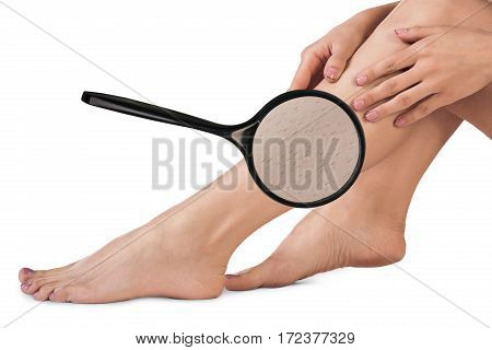 Female legs with hair. Magnifier brings hair on woman's legs.