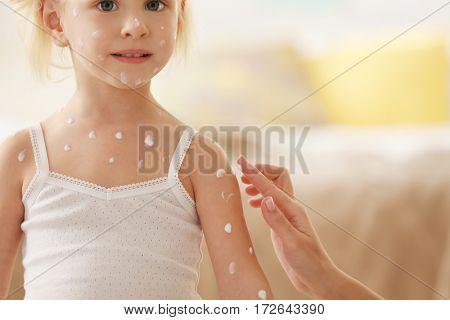 Female hand applying cream on little girl with chicken pox at home