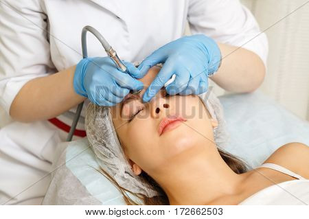 Dermabrasion girl's forehead. Instrumental cosmetology. Spa. Facial Rejuvenation. Mechanical peeling skin.