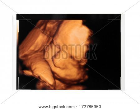 Ultrasound of baby on white background