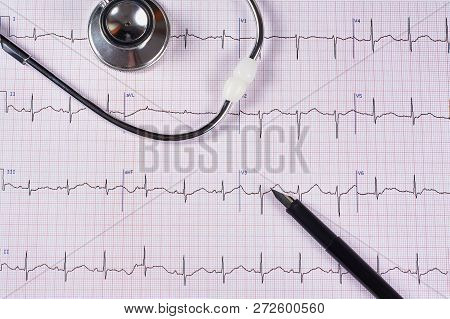 electrocardiogram ekg image photo free trial bigstock ekg graph paper