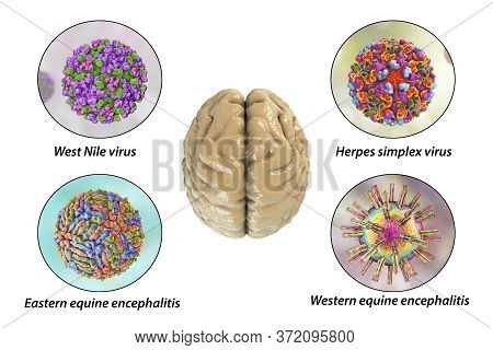 Brain Infections, Microorganisms That Cause Encephalitis And Meningitis