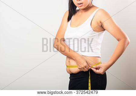 Asian Mother Woman Use Section Postpartum Scar Measuring Waist Stretch Mark Loose Lower Abdomen Skin