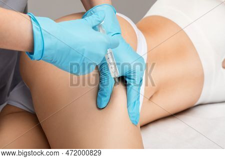 Osmetologist Makes Lipolytic Injections To Burn Fat On The Stomach And Waist Of A Woman. Female Aest