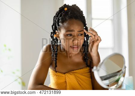 Acne Prone Skin Image & Photo (Free Trial) | Bigstock