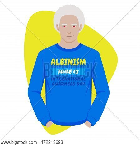 International Albinism Awareness Day. Albinism Chromosome.genetic Rare Disorder