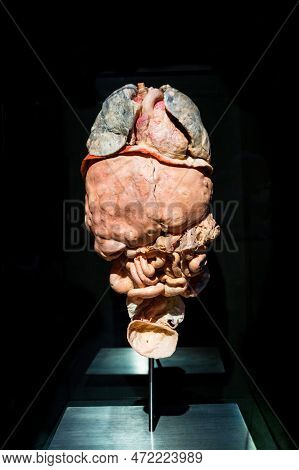 Moscow, Russia - May 05, 2021: Famous Anatomy Exhibition Body Worlds Where Plastinated Bodies Are Ex