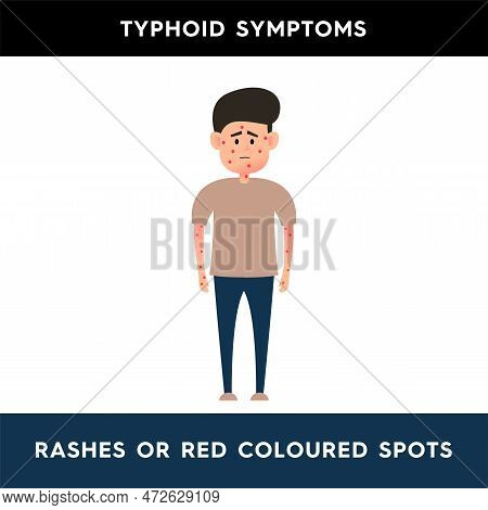 Vector Illustration Of A Man Who Developed A Red Rash All Over His Body. A Man Covered In Spots. Red