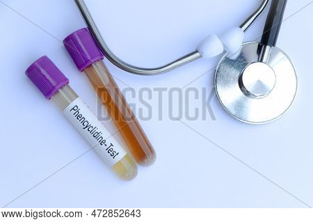 Phencyclidine Test To Look For Abnormalities From Urine,  Urine Sample To Analyze In The Laboratory,