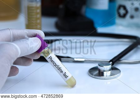Phencyclidine Test To Look For Abnormalities From Urine,  Urine Sample To Analyze In The Laboratory,