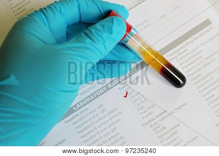 CEA testing