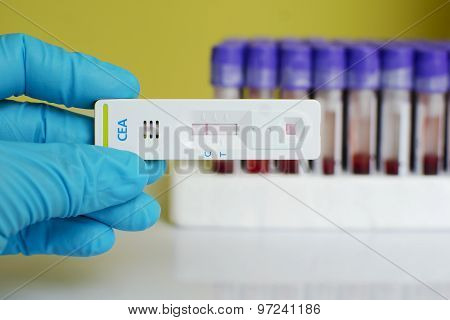 CEA negative