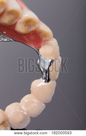 Reduced Volume Skeletal Prosthesis