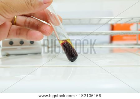 Clotted Blood  With Serum In Tes Tube  Laboratory Background.