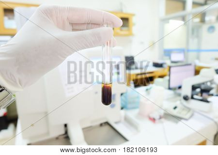 Clotted Blood  With Serum In Tes Tube  Laboratory Background.