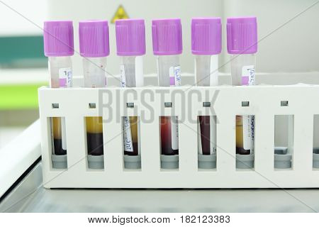 Test Tube Cbc Lab