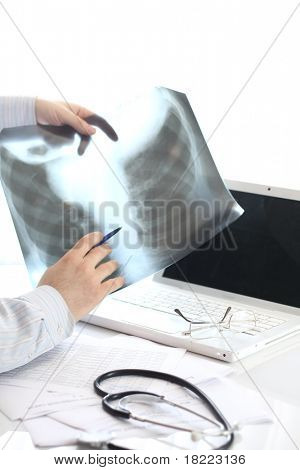 WER