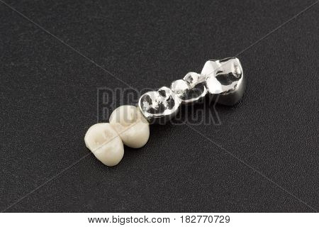 Bridged dental prostheses are made of steel and ceramic paste