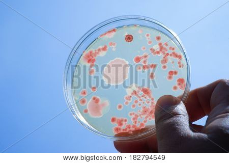 Colony of bacteria in culture medium plate Microbiology.