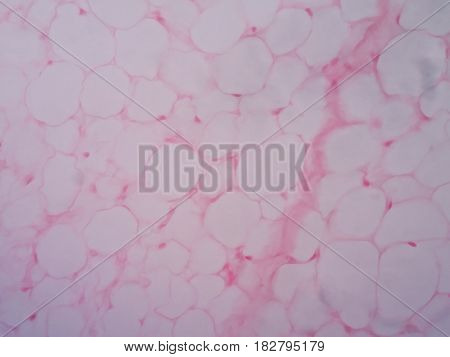 Human fat body tissue under microscope view