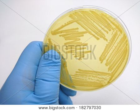 Colony of bacteria in culture medium plate Microbiology.