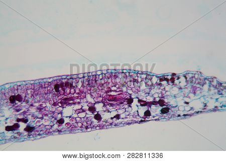 Cells Of A Plant Leaf With Damaged Epidermis And Chloroplasts Under A Microscope