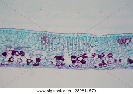 Cells Of A Plant Leaf With Damaged Epidermis And Chloroplasts Under A Microscope